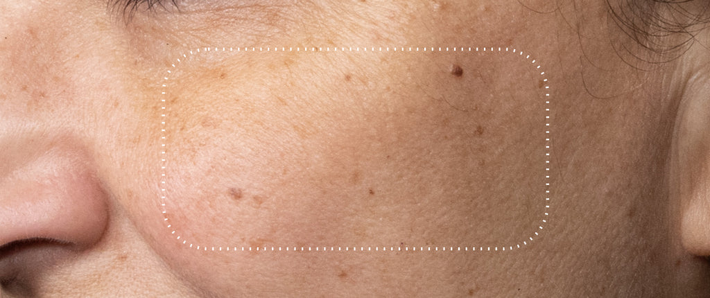 Before and after comparison of a participant’s skin over 7 days, showing visibly brighter skin with improved radiance and even tone.