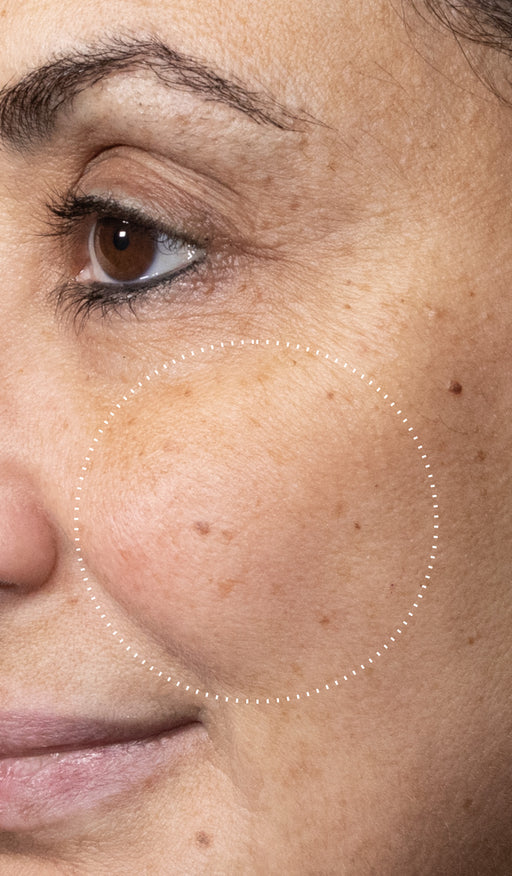 Before and after comparison of a participant’s skin over 7 days, showing visibly brighter skin with improved radiance and even tone.