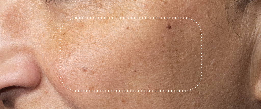 Before and after comparison of a participant’s skin over 7 days, showing visibly brighter skin with improved radiance and even tone.