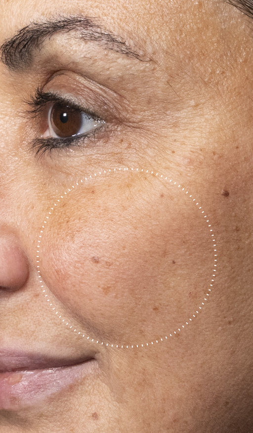 Before and after comparison of a participant’s skin over 7 days, showing visibly brighter skin with improved radiance and even tone.