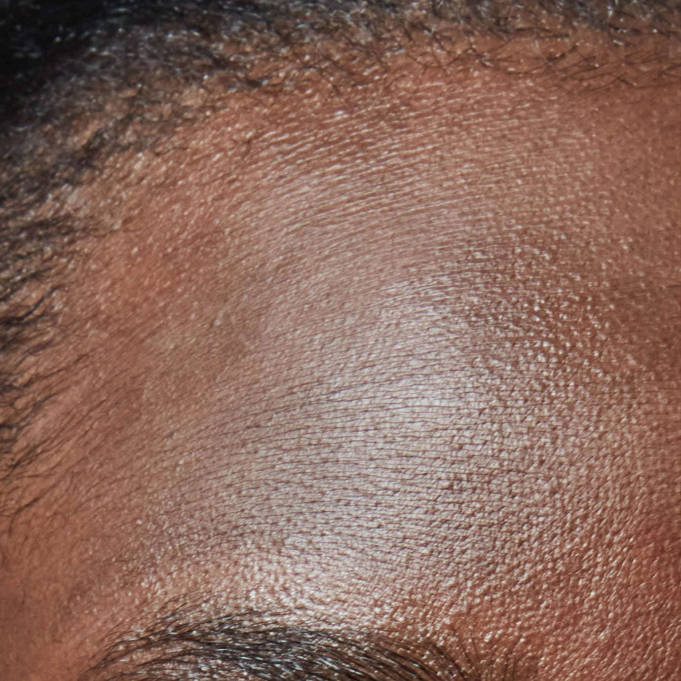 Dry and Dehydrated Skin