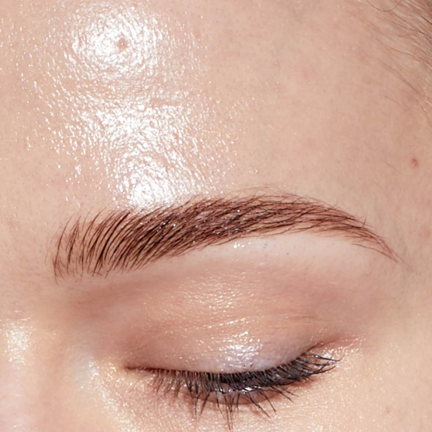 Enlarged Pores