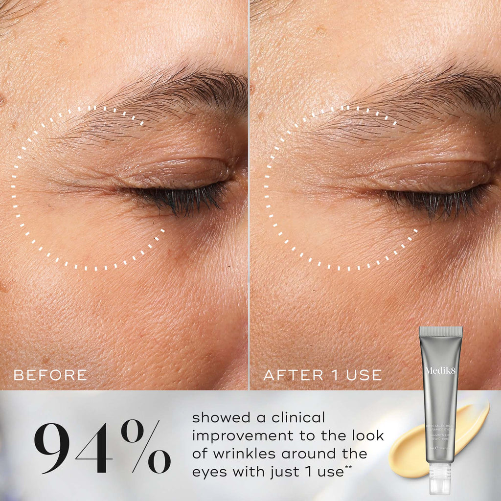 Eye Sebum Crystal Retinal Ceramide Eye | Vitamin A Serum – Medik8