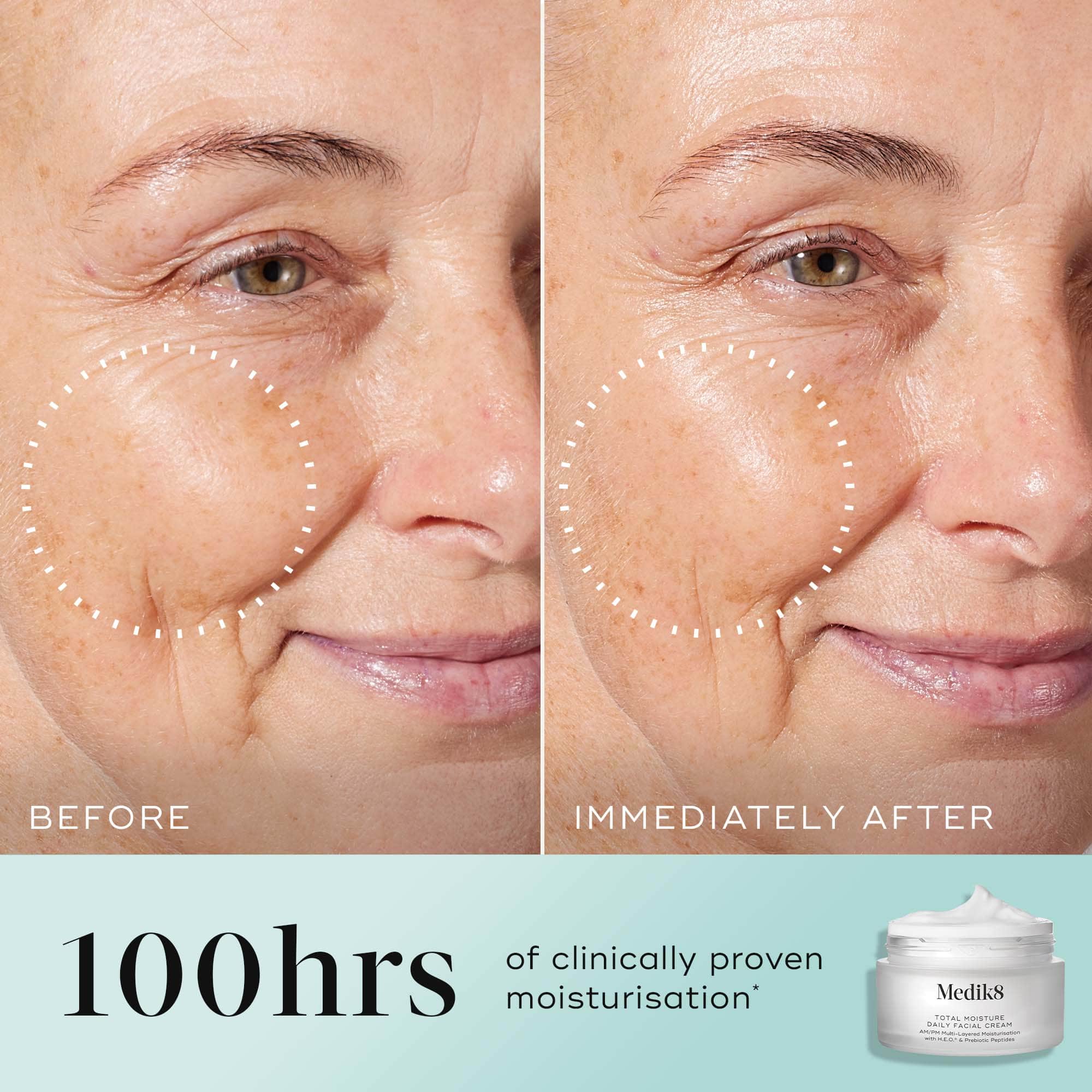 Total Moisture Daily Facial Cream Refill™ – Medik8