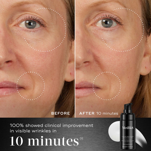 Before and after comparison of a participant’s face displayed next to the Medik8 Liquid Peptides Advanced MP bottle. Visuals demonstrate reduced wrinkles around the eyes and mouth. Text highlights that 100% showed clinical improvement in visible wrinkles in 10 minutes.