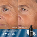  A split image showing the 'Before' and 'After' results of a skincare product on a person's forehead. The top half, labeled 'BEFORE', shows noticeable forehead wrinkles. The bottom half, labeled 'AFTER', shows a significant reduction in the appearance of wrinkles, with a small tube of product visible in the bottom right corner. The number '9 10' is visible on the bottom left.
