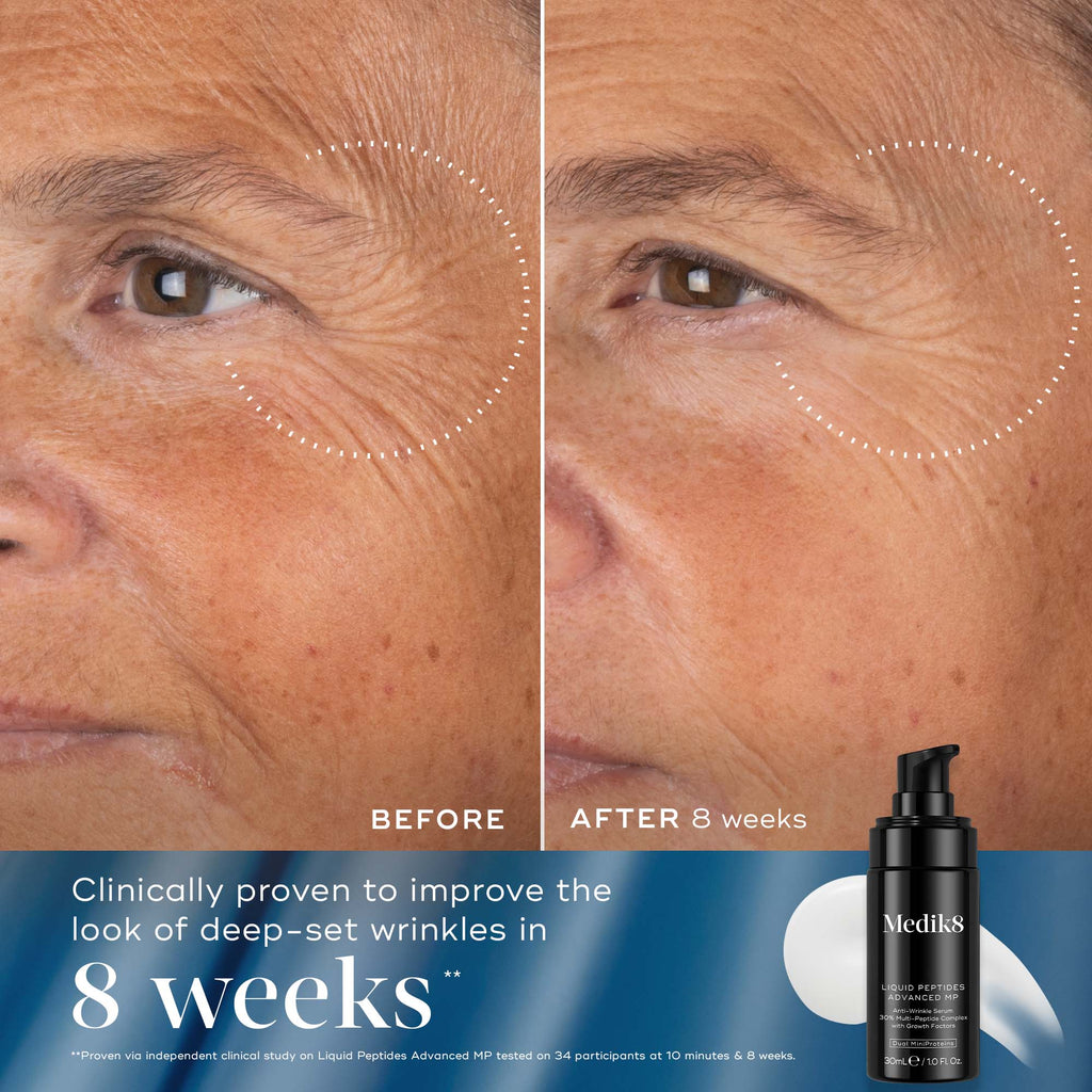  A split image showing the 'Before' and 'After' results of a skincare product on a person's forehead. The top half, labeled 'BEFORE', shows noticeable forehead wrinkles. The bottom half, labeled 'AFTER', shows a significant reduction in the appearance of wrinkles, with a small tube of product visible in the bottom right corner. The number '9 10' is visible on the bottom left.