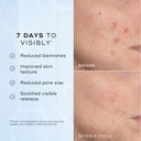 Niacinamide Peptides