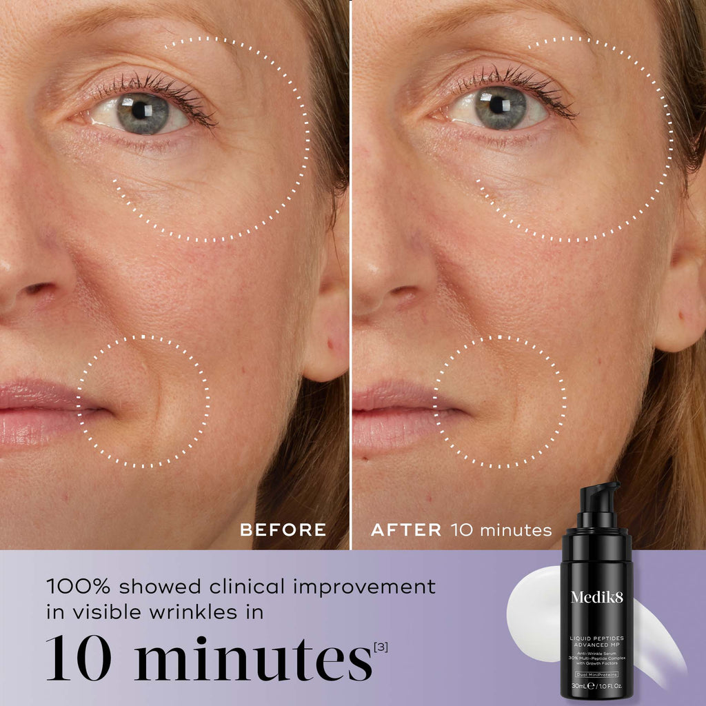 A before-and-after close-up of a face, showing smoothed skin around the eye and mouth in the "After 10 minutes" image compared to "Before." Text states "100% showed clinical improvement in visible wrinkles in 10 minutes*". A bottle of Liquid Peptides Advanced MP is displayed in the corner.