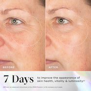 A before-and-after close-up of a participant's eye and cheek area, with dotted circles highlighting visibly smoother skin and reduced fine lines in the "AFTER" image. Text states "7 Days to improve the appearance of skin health, vitality & luminosity". A footnote references an independent clinical study on Exo-PDRN Prismatic+ on 60 volunteers over 4 weeks.