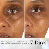 A before and after close-up of a participant's cheek area, with dotted circles highlighting visibly smoother skin texture. Text below on a holographic background states: "Clinically proven to visibly improve skin texture & smoothness by 43% in 7 Days." A footnote confirms this was proven via an independent clinical study on Exo-PDRN Prismatic+ on 60 volunteers over 4 weeks.