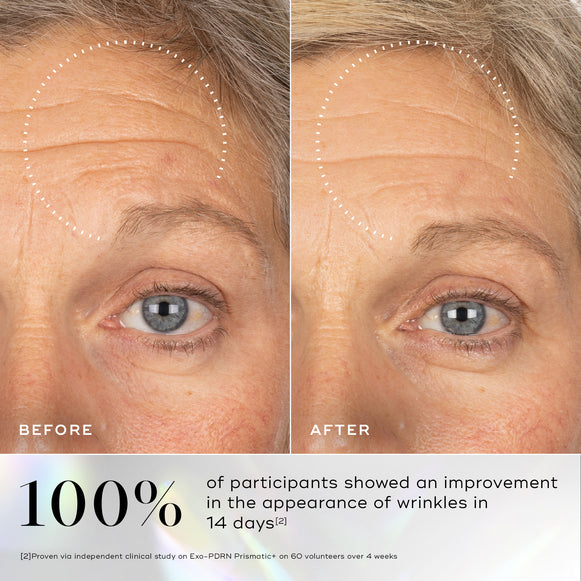 Before-and-after images of skin showing visible wrinkles around the eye area with improvement highlighted after using Medik8 Exo-PDRN Prismatic+ serum.-hover-2
