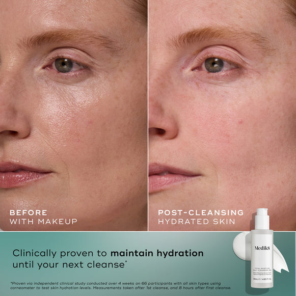 Total Moisture Daily Cleansing Gel-hover-1