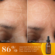 Before and after comparison of a participant’s forehead over 4 weeks, with a white dotted circle highlighting a visible reduction in the look of fine lines and wrinkles. The bottom of the image features a warm orange-gold background with a Medik8 C-Tetra Luxe serum bottle and the claim "86% reported that it was the best Vitamin C serum they had ever tried*."